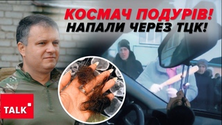 Шукали навідницю вонкома  напали НА ДИТИНУ і МАТІР
