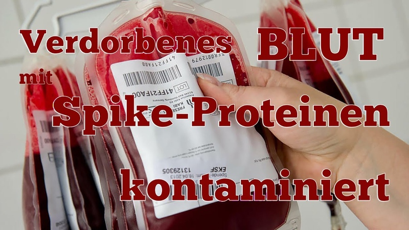 VERDORBENES BLUT: 80 der Blutvorräte sind mit Spike Proteinen aus m RNA Spritzen