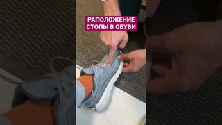 Шнурование, создание правильной геометрии стопы. #плоскостопие #шнуровка #стельки #плоскостопие #шн