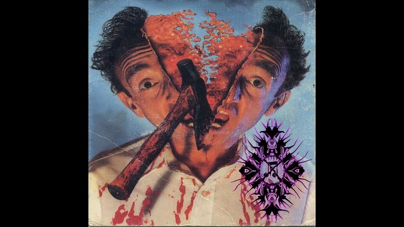 Leucodistrofia Demo 4