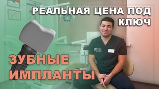 ЗУБНЫЕ ИМПЛАНТЫ. Из чего складывается РЕАЛЬНАЯ ЦЕНА «‎под ключ»‎. Врач-стоматолог Ацамаз Бекоев