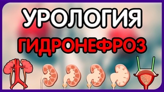 Урология. Лекция 7. Гидронефроз. Гидронефротическая трансформация почек