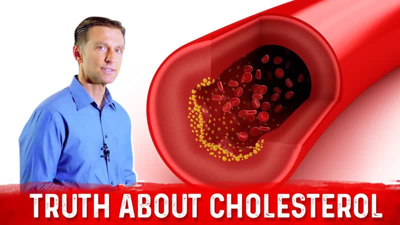 The Truth About Cholesterol LDL Cholesterol HDL