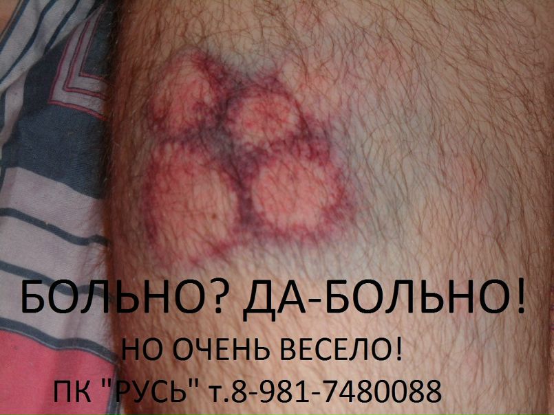 №10, Руслан Псеуш №10, Руслан Псеуш