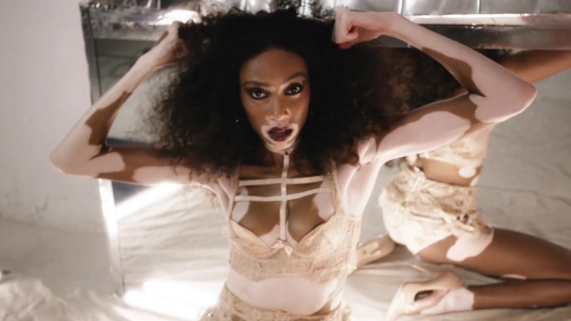 DAY 15 Winnie Harlow by Phil
