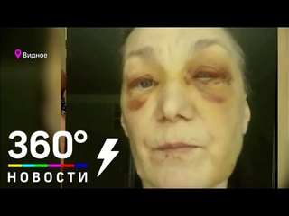 Пенсионерку из города Видное избила пьяная компания во главе с соседом по лестничной клетке