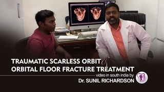 Traumatic scarless Orbit and orbital floor fracture treatment by prof dr sunil richardson