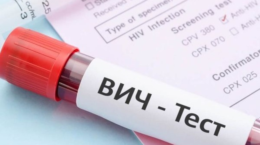 В КЧР увеличилось количество ВИЧ-инфицированного населения