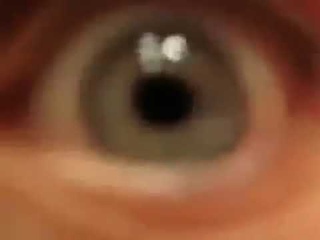 Видишь мой глаз????