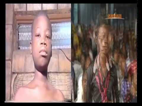 Т. Б. Джошуа ( TB Joshua) Boy healed of swollen