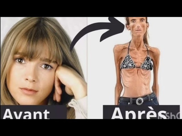 À quoi ressemblent les acteurs de la série télévisée Hélène et les garçons