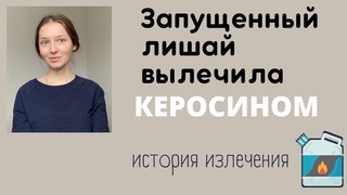 Стригущий лишай быстро вылечился...керосином!